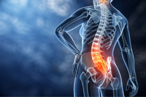 Sciatica