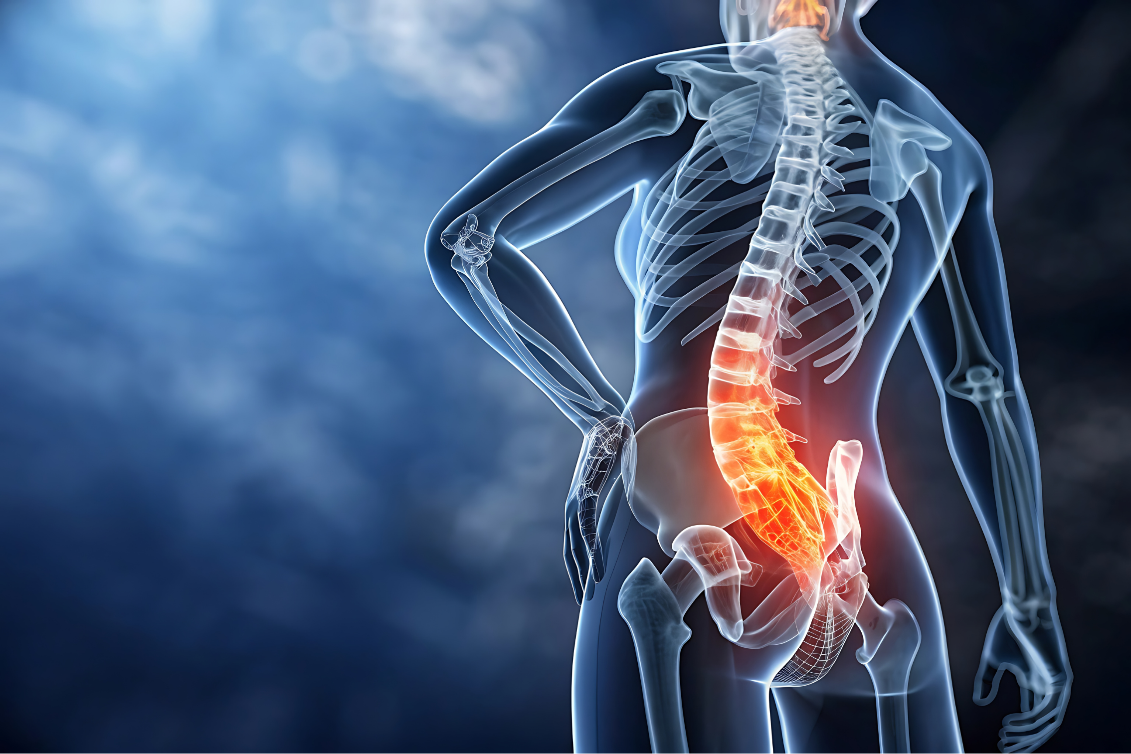 Sciatica